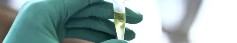 Cerebrospinal fluid (CSF) and Genetics